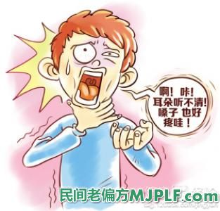 咽喉炎