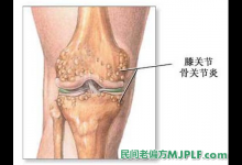 五个食疗偏方治疗骨质增生